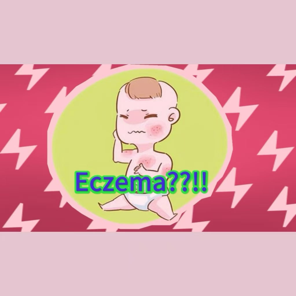 Doctor’s Suggestion about Baby’s Eczema                  -A Mother’s Parenting Experience Diary(1)